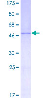 12.5% SDS-PAGE Stained with Coomassie Blue.